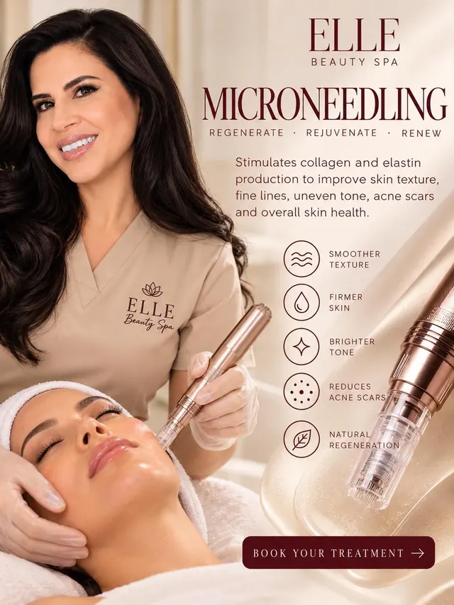 Microneedling en ELLE Beauty Spa: piel más lisa, firme y luminosa